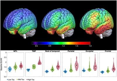 Evaluation of partial volume correction and analysis of longitudinal [18F]GTP1 tau PET imaging in Alzheimer's disease using linear mixed-effects models